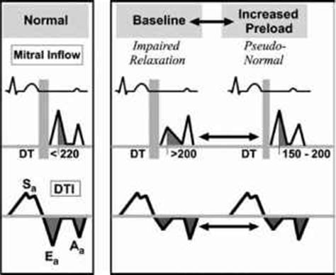 impaired left ventricular relaxation meaning.